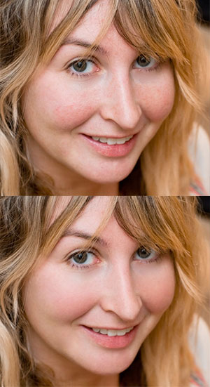 Image Doctor 2 - Retouching Photoshop Plugins - Plus 10% Discount