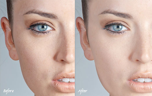 Simple Skin Retouching Techniques - Photoshop Tutorial